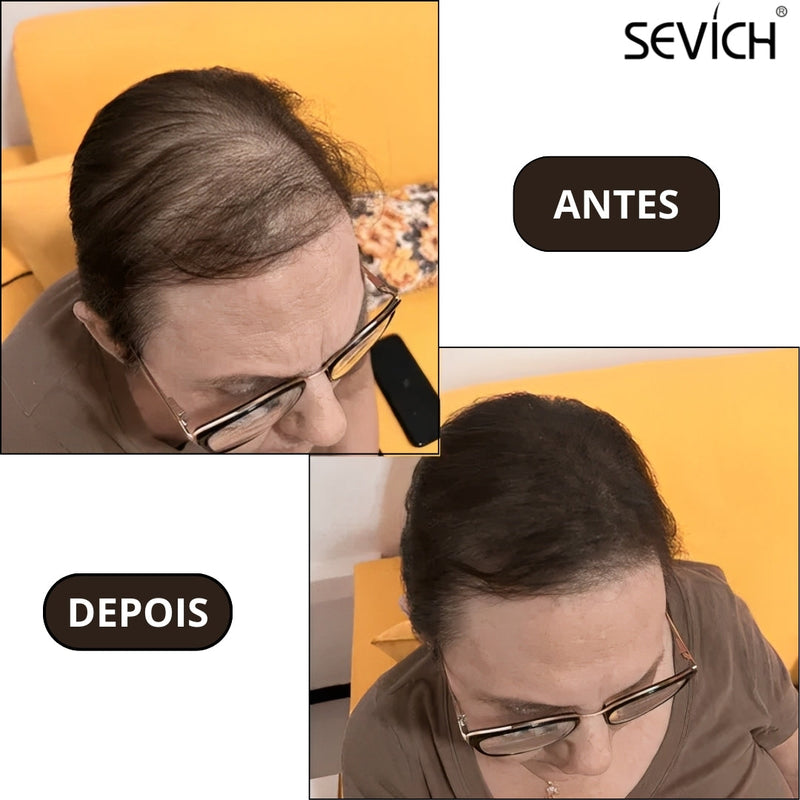 Pó Capilar HairFix SEVÍCH – Fim das Falhas e Raízes Expostas
