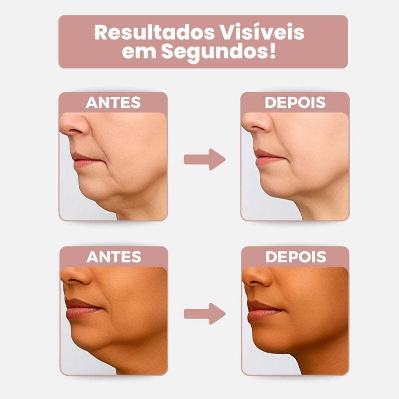 Belle Lift® - Adesivo Lifting Antirrugas e Contra Flacidez no Pescoço em Bege da categoria Adesivo Belle Lift P3 na ShopBran